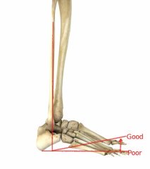 Ankle Dorsiflexion-Glute Interaction