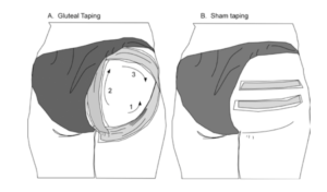 Stroke Taping Technique