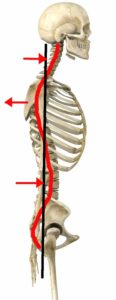 kyphotic-spine-graphic