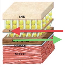 Poorly Aligned Tissue