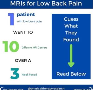 What Does an MRI Tell Us?